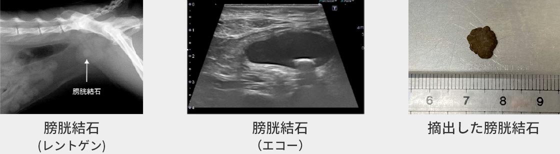 膀胱結⽯の症例