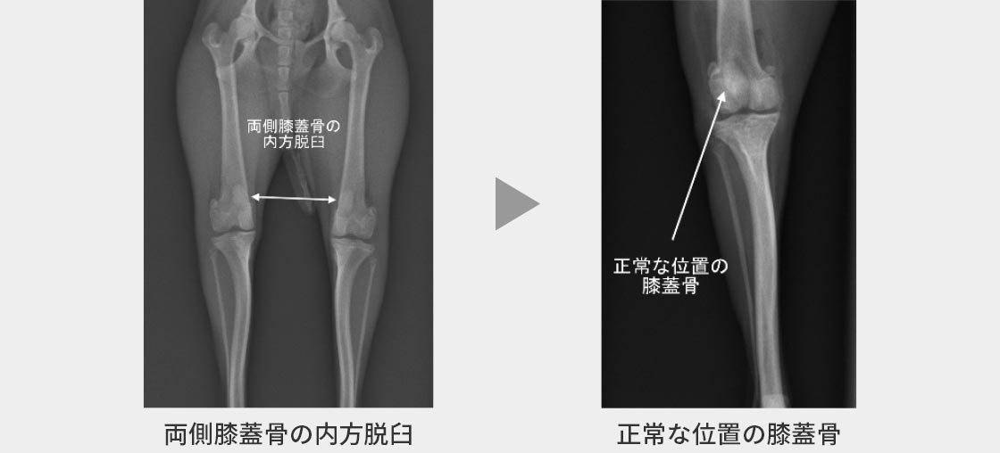 右肩関節脱⾅の症例