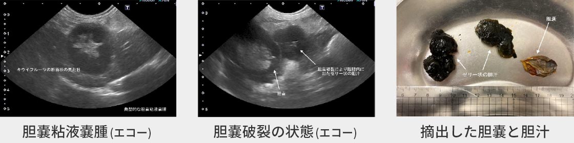 異物誤飲の症例01
