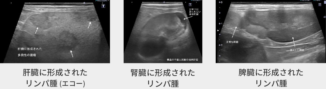 右肩関節脱⾅の症例