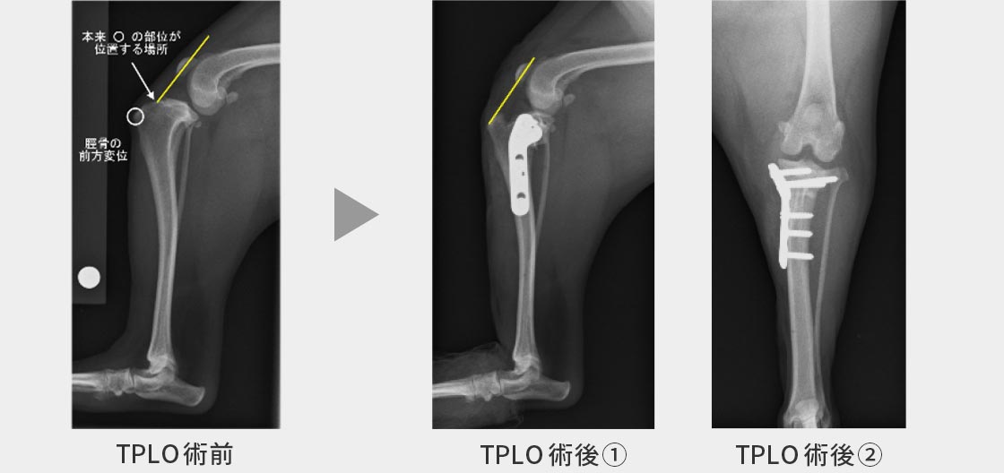 前⼗字靭帯断裂に対するTPLOの症例