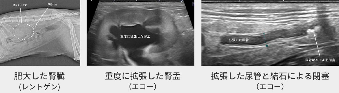 尿管結⽯の症例