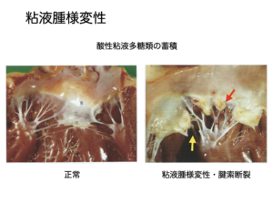 犬の僧帽弁閉鎖不全症と歯周病 定期的な歯石除去の推奨 杉並区 荻窪の動物病院 荻窪桃井どうぶつ病院 杉並動物循環器クリニック