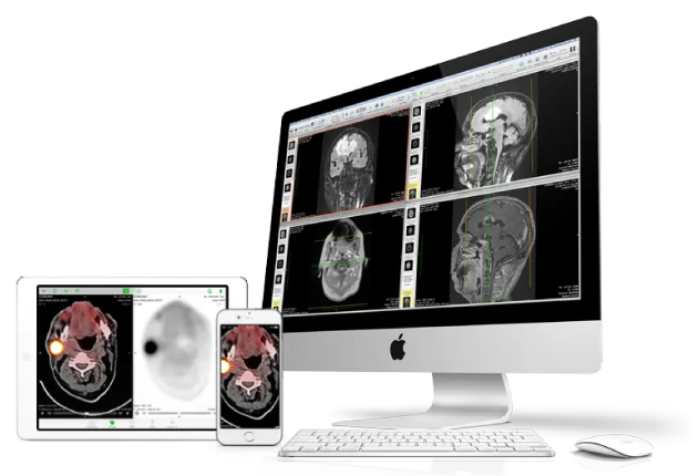 OsiriX DICOM Viewer